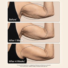 Before and after results on upper arms over 4 weeks
