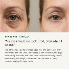 Before and after around the eyes