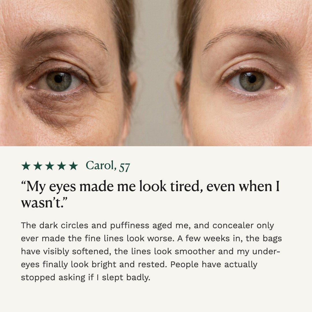 Before and after around the eyes
