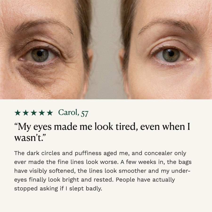 Before and after around the eyes