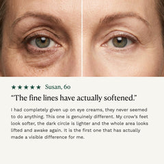 Before and after on the eye area
