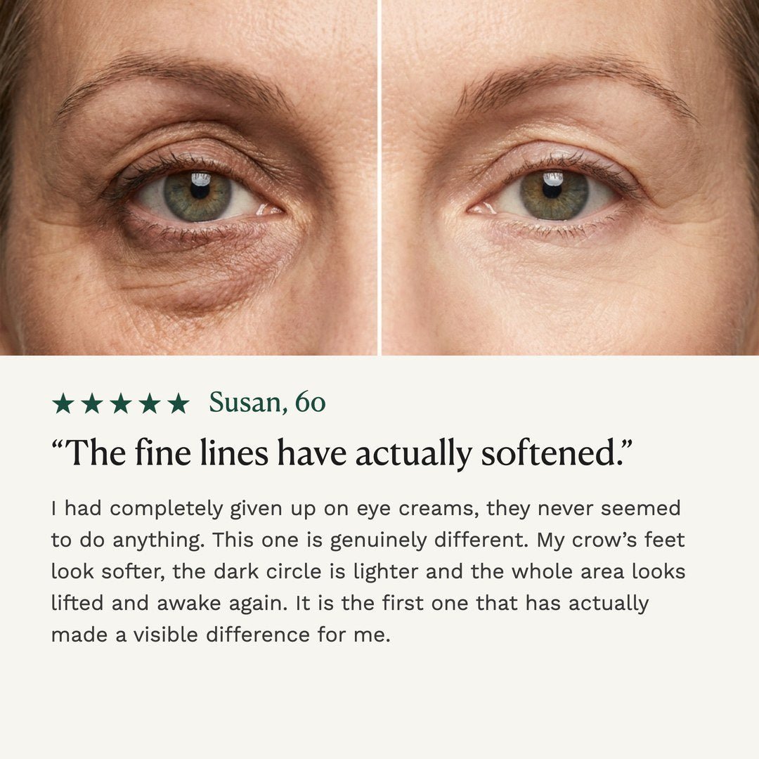 Before and after on the eye area