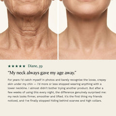 Before and after on the neck