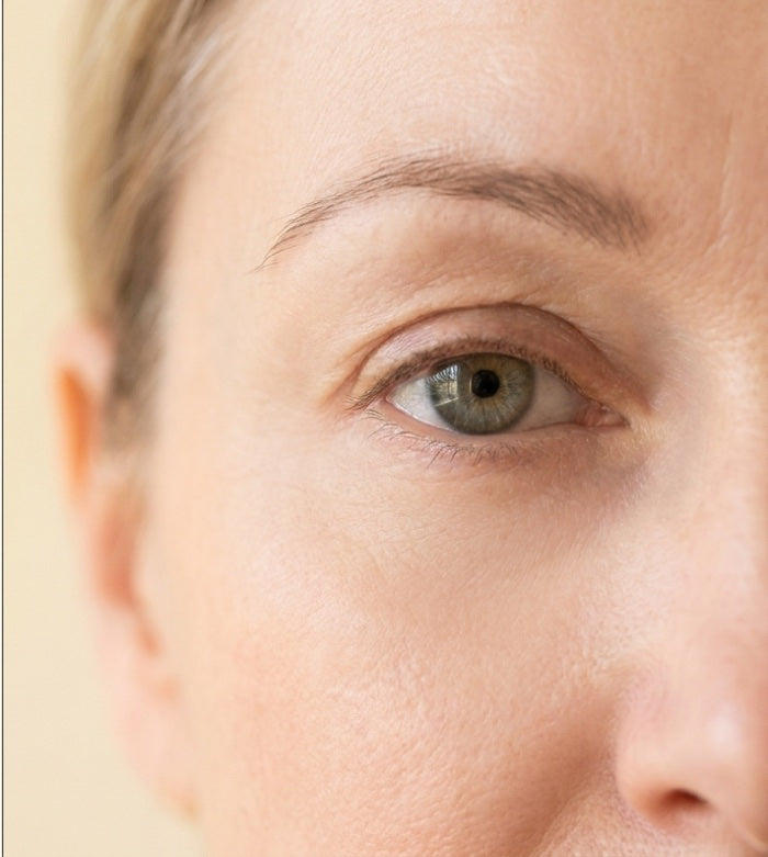 After: Visibly Smoother, Brighter Eyes