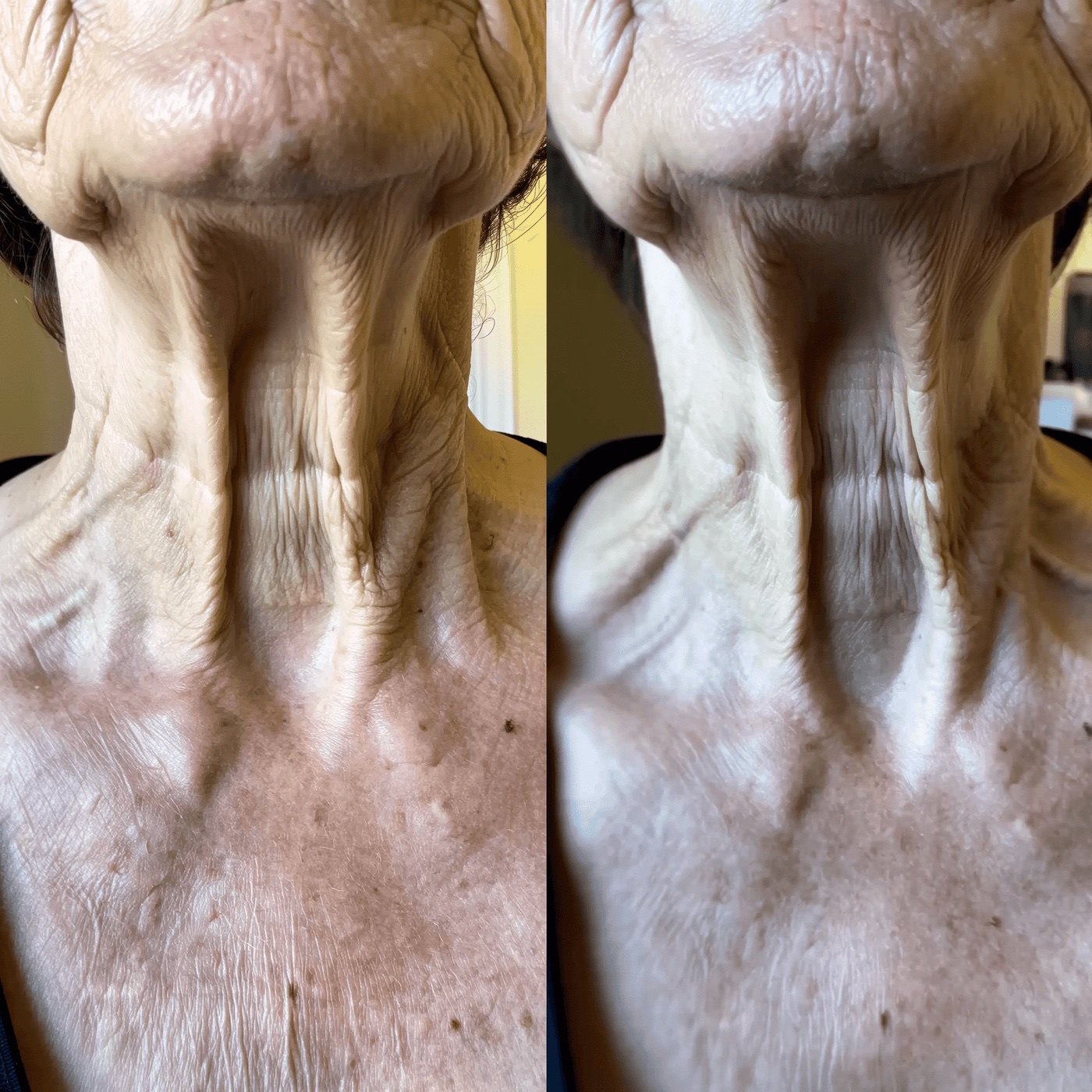 Patricia L. (69)